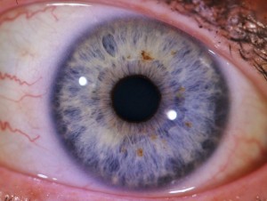 Iris bleu. Lymphatique fibrillaire